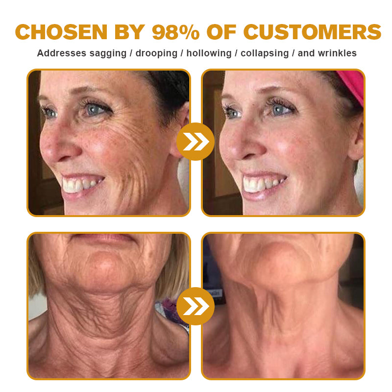 Made and dispatched in the UKâš ð§ðð¢ð£ð® Botox Bee Venom Wrinkle Removal Creamðšââïžðððð ððððšðŠðŠðð§ðððâšLAST DAY 80% OFF