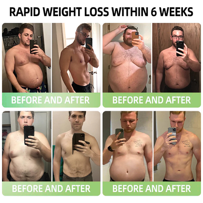 𝐓𝐋𝐎𝐏𝐀® 𝐆𝐋𝐏-𝟏 𝐒𝐥𝐢𝐦𝐦𝐢𝐧𝐠 & 𝐇𝐞𝐚𝐥𝐭𝐡 𝐁𝐨𝐨𝐬𝐭 𝐃𝐫𝐨𝐩𝐬 (𝐅𝐨𝐨𝐝-𝐠𝐫𝐚𝐝𝐞 𝐅𝐚𝐭 𝐁𝐮𝐫𝐧𝐞𝐫)👨‍⚕️