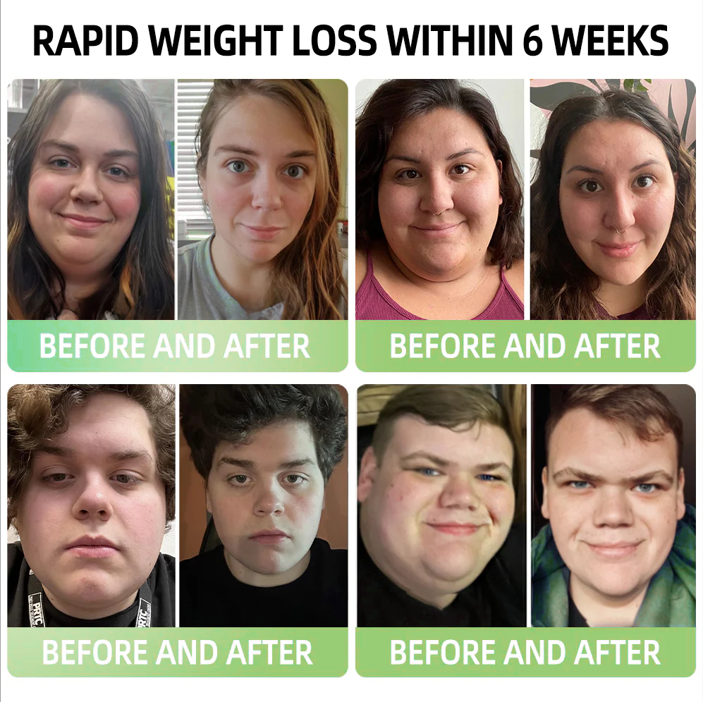 𝐓𝐋𝐎𝐏𝐀® 𝐆𝐋𝐏-𝟏 𝐒𝐥𝐢𝐦𝐦𝐢𝐧𝐠 & 𝐇𝐞𝐚𝐥𝐭𝐡 𝐁𝐨𝐨𝐬𝐭 𝐃𝐫𝐨𝐩𝐬 (𝐅𝐨𝐨𝐝-𝐠𝐫𝐚𝐝𝐞 𝐅𝐚𝐭 𝐁𝐮𝐫𝐧𝐞𝐫)👨‍⚕️