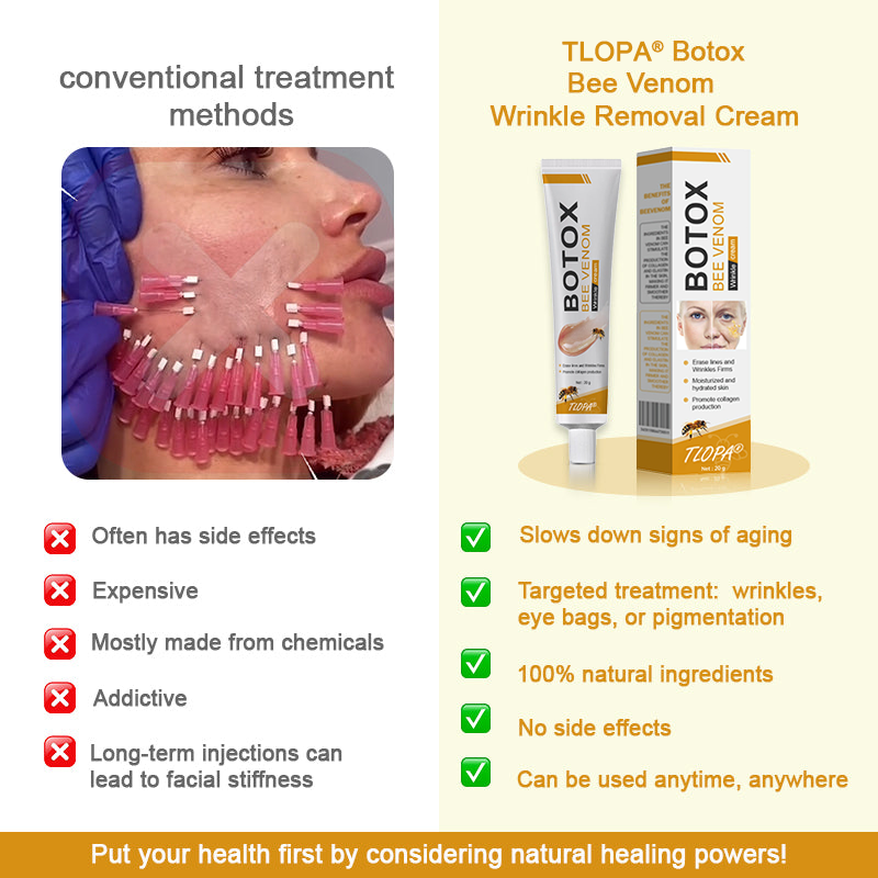 Made and dispatched in the UK✨ 𝗧𝗟𝗢𝗣𝗔® Botox Bee Venom Wrinkle Removal Cream👨‍⚕️𝐌𝐇𝐑𝐀 𝐑𝐞𝐜𝐨𝐦𝐦𝐞𝐧𝐝𝐞𝐝✨LAST DAY 80% OFF