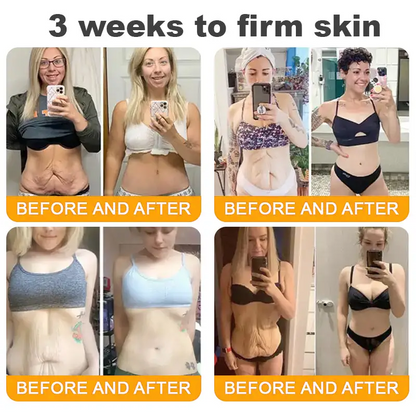 Made and Shipped from UK ✨ TLOPA® Bee Venom Skin Restoration Cream ⏰ LAST DAY 80% OFF🥑