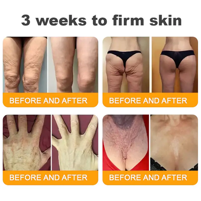 Made and Shipped from UK ✨ TLOPA® Bee Venom Skin Restoration Cream ⏰ LAST DAY 80% OFF🥑