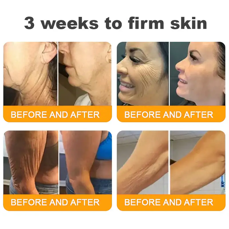 Made and Shipped from UK ✨ TLOPA® Bee Venom Skin Restoration Cream ⏰ LAST DAY 80% OFF🥑